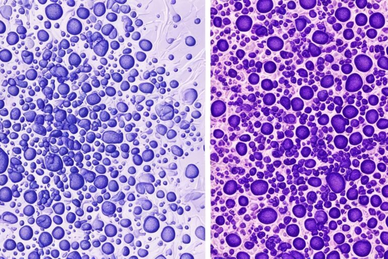 Alcohol's Role in Skin Cell Aging